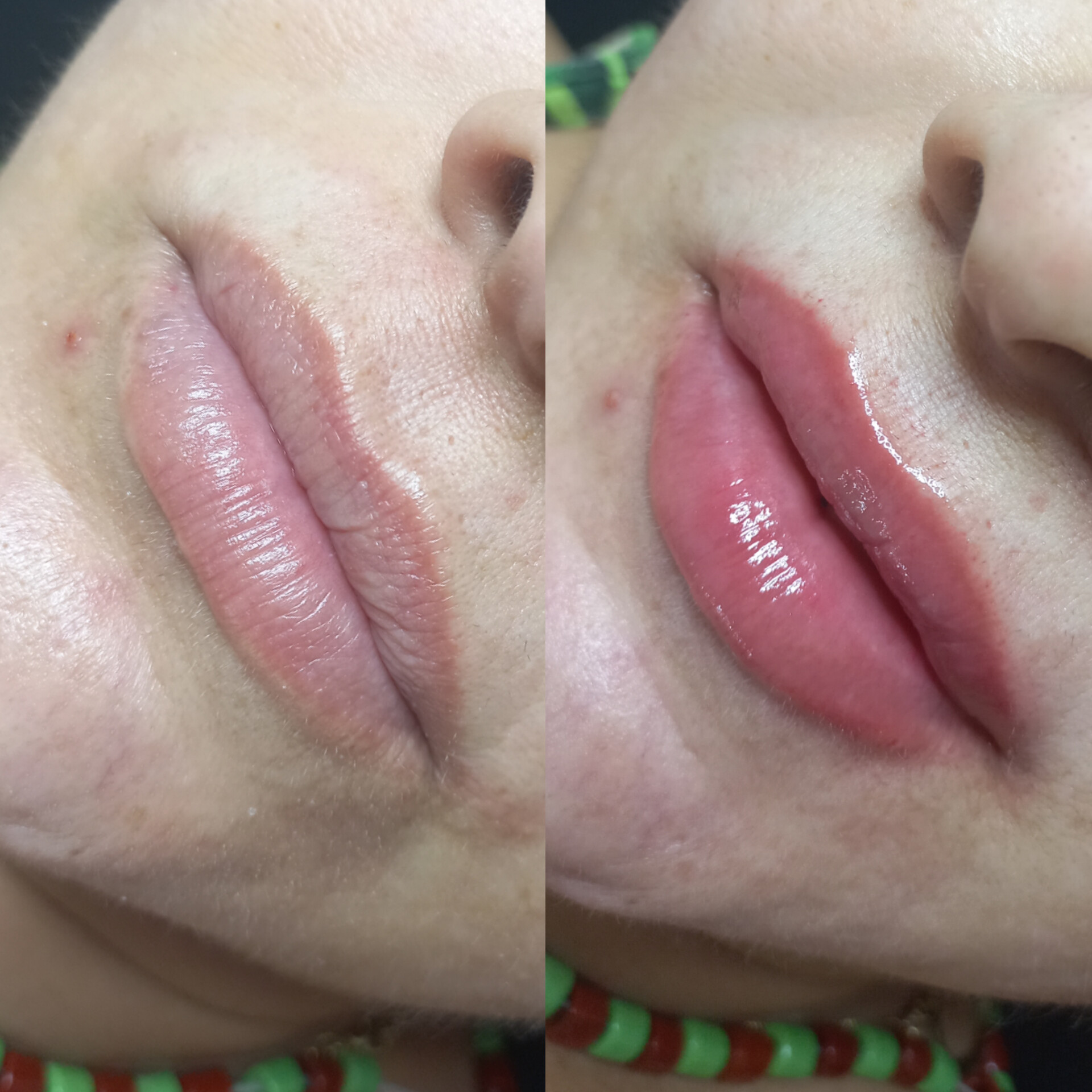 Hydra Gloss